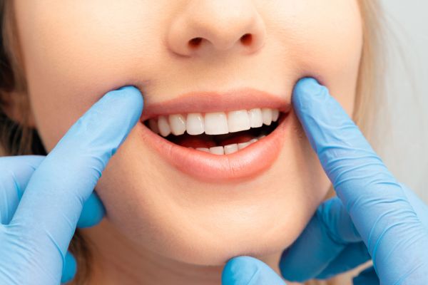 Dental Care Tips for Young Athletes